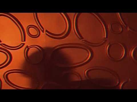 que voy a hacer conmigo??? - Elsa y Elmar (No Official Music Video)