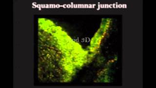 High-Res Microscope May Be Future of Cervical Cancer Screening