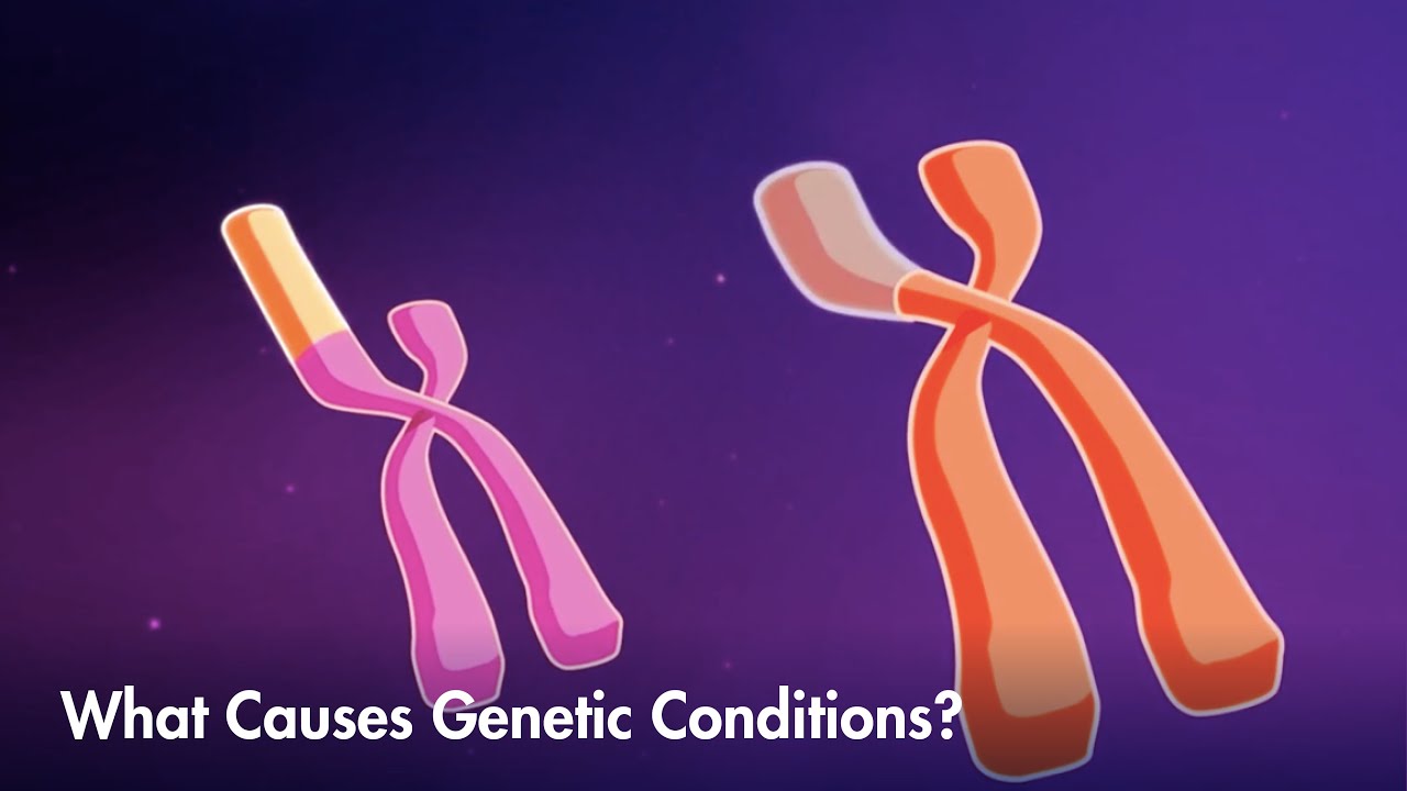 What are the two main causes of variation?