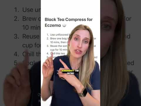 This common household cure is THE BEST. #eczema