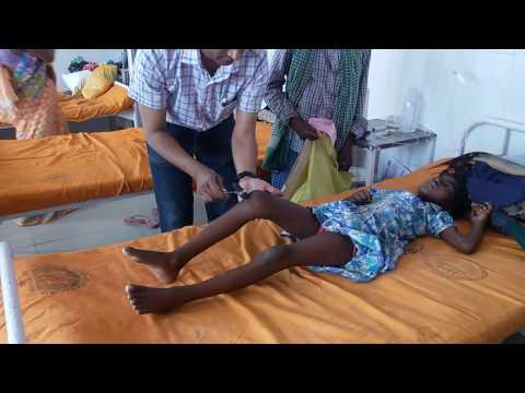 Watch lagu Images Videos Cerebral Palsy Upper Motor Neuron, Watch Images Cerebral Palsy Upper Motor Neuron free Watchn, video klip Cerebral Palsy Upper Motor Neuron