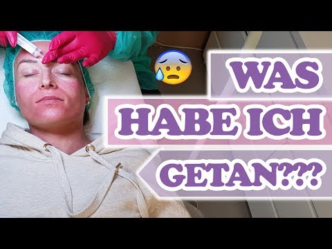 Die Prophylaxe gribka die Füsse der Kinder Ob gribok der Nägel das Jod helfen wird