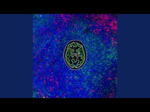 How Does the Brain Respond to Works of Art?