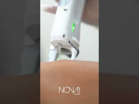 Laser Hair Removal Treatment!