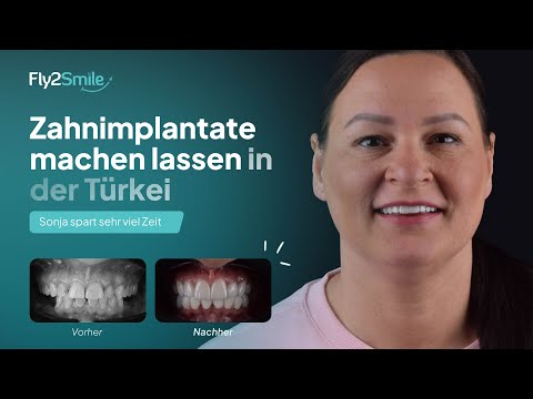 Zahnimplantate - Zahnkronen Türkei: Sonja erhält neues Lächeln in kürzester Zeit