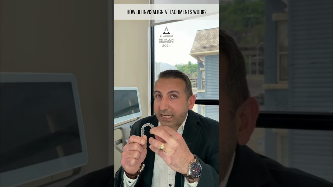How Do Clear Aligner Attachments Work #dentist #smiledentist #doctor #invisalign #invisaligndentist