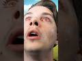 April 8th Solar Eclipse Solareclipse Funny Skit