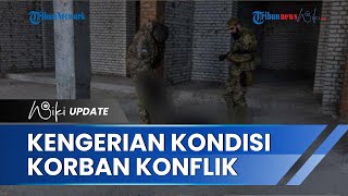 Relawan Medis Ungkap Kengerian Kondisi Pasien akibat Konflik Rusia di Ukraina: Ini Neraka