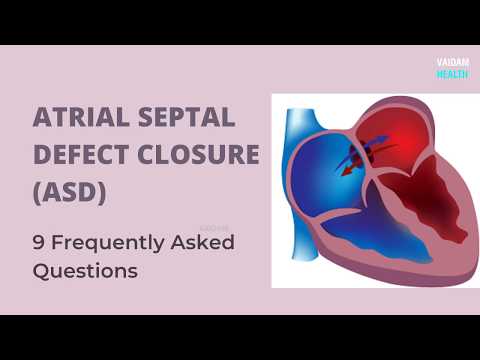 ASD Closure - 9 Frequently Asked Questions