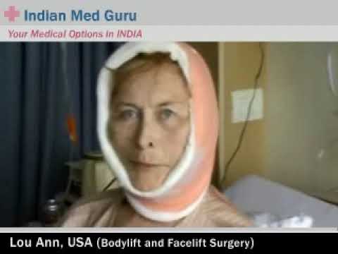 American Lady's Facelift Surgery in India.