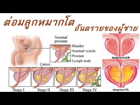 ซื้อค้อนลดลงของ ธ อร์ในคราเมนชู ยิมนาสติกที่เพิ่มขึ้นแรง