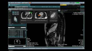 ECHELON Synergy Cardiac MRI Virtual Demo with Fujifilm