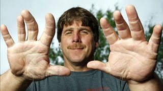 The Biggest Hands In The World