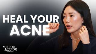 How To Heal Your Acne and The Myth of "Dermatologist Tested" Products | Mirror Mirror The Inbox