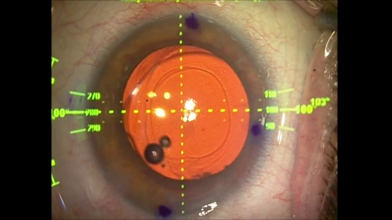 Miguel Angel Ibañez Hernandez-30