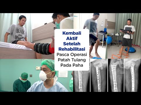 Kembali Aktif Setelah Rehabilitasi Pasca Operasi Patah Tulang