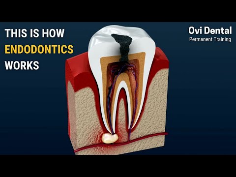 THIS IS HOW ENDODONTICS WORKS