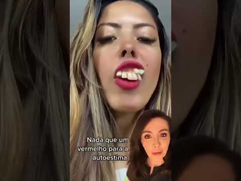 What Is Hyperdontia ?!