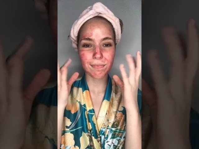 Vídeo relacionado con The Ordinary AHA 30% + BHA 2% Peeling Solution, Solución Exfoliante con Alfahidroxiácidos y Betahidroxiácidos, Exfoliación avanzada para una piel más luminosa, 30 ml