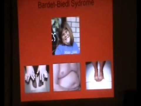 2011 Retinitis Pigmentosa Association - Holland Part1