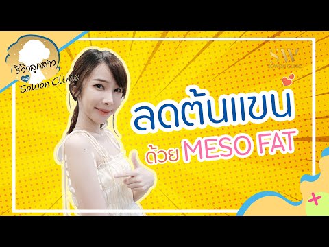 เมโสแฟต ยี่ห้อไหนดี