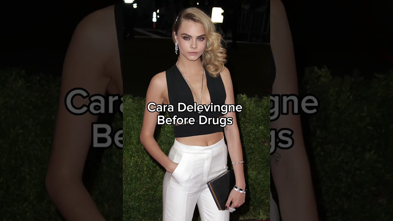 Cara Delevingne before and after drugs 💔 ❤️‍🩹  #modelingagency  #drugaddiction #caradelevingne