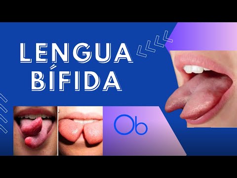 Lengua Bífida 👅 🐍