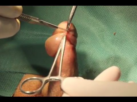Come eccitare donna Cancro Più donna eccitata