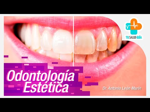 Odontología Estética | Tu Salud Guía