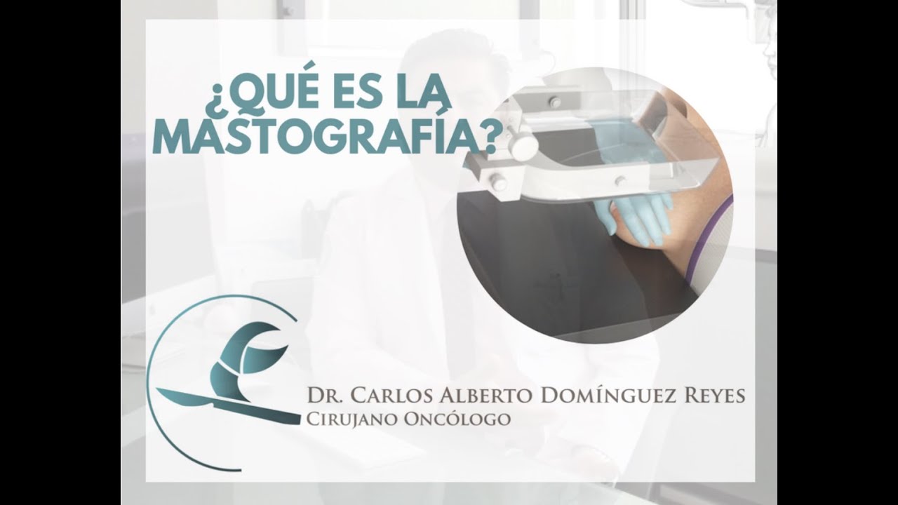 Carlos Alberto Domínguez Reyes-8