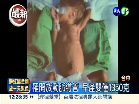 體重最輕心導管患者 2月嬰康復