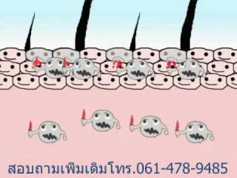 มาตรฐานการรักษาของโรคสะเก็ดเงิน 2014 โลชั่นจีนร่างกายบริสุทธิ์เพื่อโรคสะเก็ดเงิน