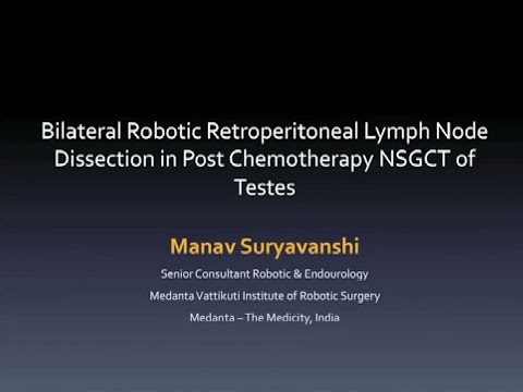 Bilateral Robotic Retroperitoneal Lymph Node Dissection