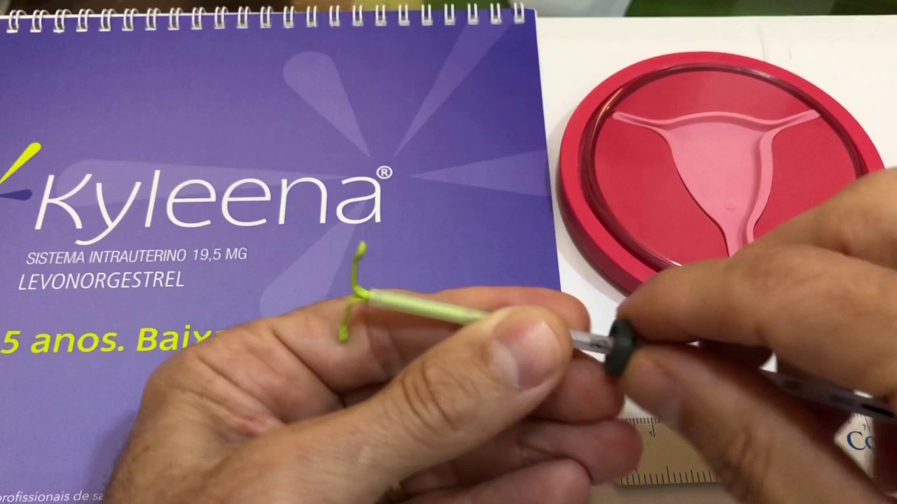 Novo DIU - menos hormônio