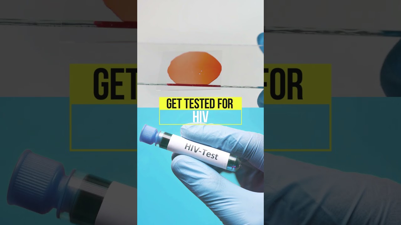 HIV testing at CA medylynks