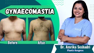 DON'T GET GYNAECOMASTIA TREATMENT (until you watch this video) - By Amrika Seshadri #plasticsurgery
