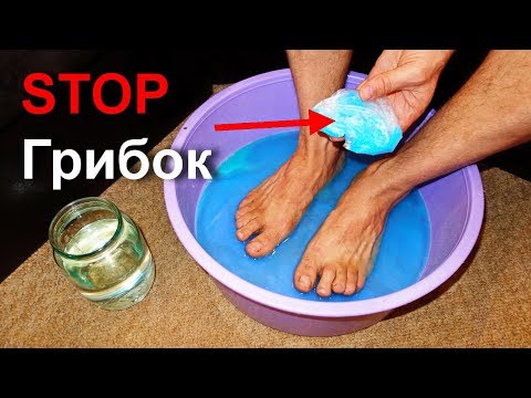Gribok die Füsse, die Heime zu behandeln Was bei gribke der Nägel auf den Beinen helfen wird