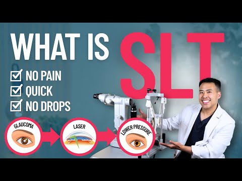 What is SLT? Is This the Best Treatment for Glaucoma?