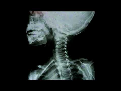 vowl. x brothel - sink