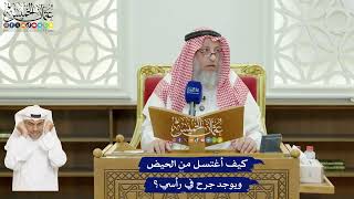 615 - كيف أغتسل من الحيض ويوجد جرح في رأسي؟ - عثمان الخميس