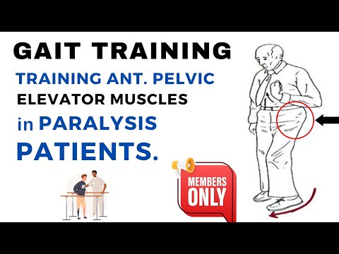 UPPER LIMB TRAINING SCAPULA ACTIVATION EXERCISE POST STROKE PHYSIOTHERAPY REHABILITATION