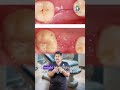 தையல் பிரிந்தால் என்ன செய்வது What To Do If Sutu