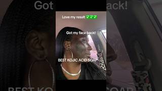 Download lagu Sabun Asam Kojik Terbaik, wajahku kembali seperti semula, suka hasilnya❤️ mp3 Download lagu Sabun Asam Kojik Terbaik, wajahku kembali seperti semula, suka hasilnya❤️ mp3