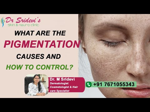 Pigmentation Causes and Control | Dr. Sridevi