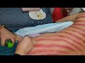 Ilang Lorone Teko Warase Wait Full Videonya Kerokan Gosong Dajengchannel