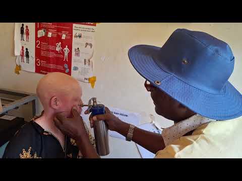 SNUPA dermatologist performing cryotherapy at Muyembe HC IV in Bulambuli district.