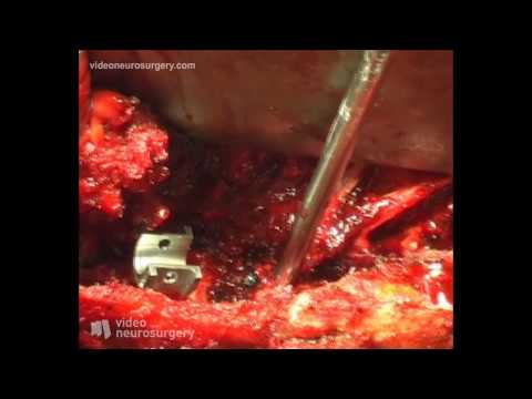 Dolore alle articolazioni dopo 60 anni Il mal di schiena dopo il parto dopo lanestesia epidurale