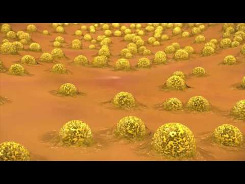 Elite Dental Care video.