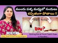 3 Best Teeth Gap Treatment Diastema Gap Teeth Filling Palla Sandulu In Telugu Dr Swetha