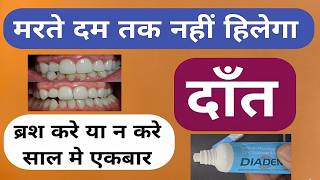 मरते दम तक नहीं हिलेगा एक भी दाँत 100 साल तक का गारंटी Diadent Toothpaste For All Teeth Problems